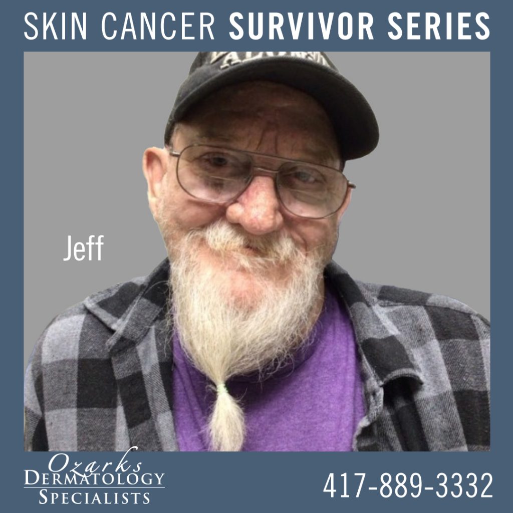 Skin Cancer - Survivor Series - Jeff Photo